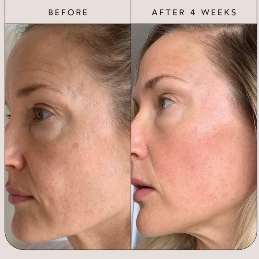 TRUE BOTANICALS RENEW CHEBULA ACTIVE SERUM - Picture 5 of 6